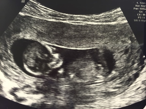 May 2016 babies - thread 2!