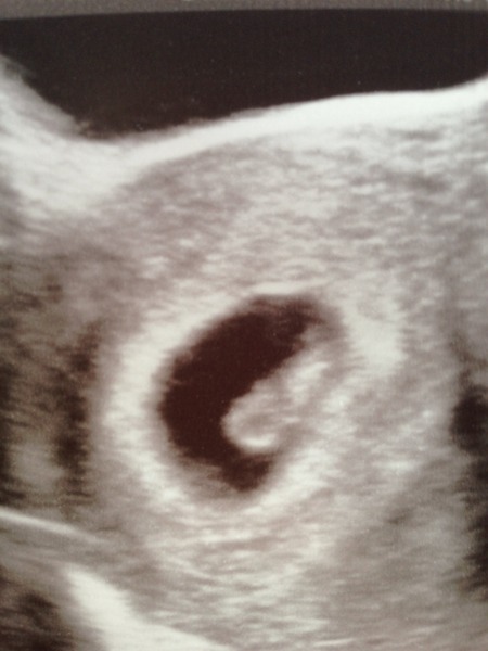 June 2016 #3, 12 week scans - Will you PLEASE hurry up?
