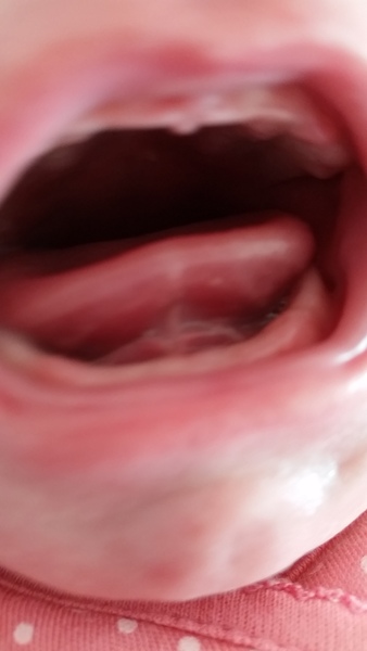 Would a tongue tie be very obvious?
