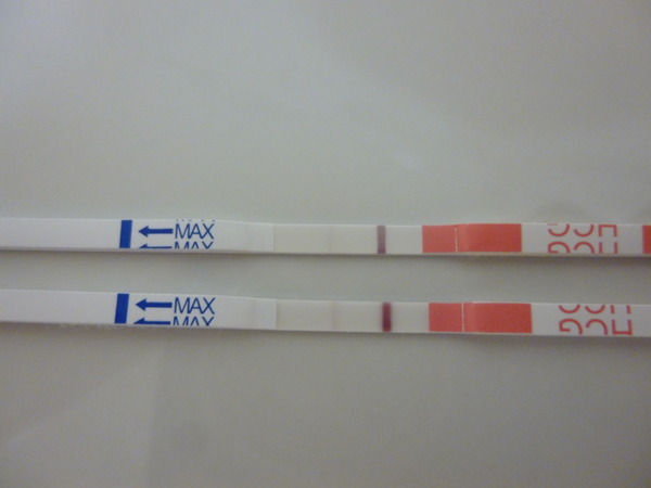 Short Luteal Phase