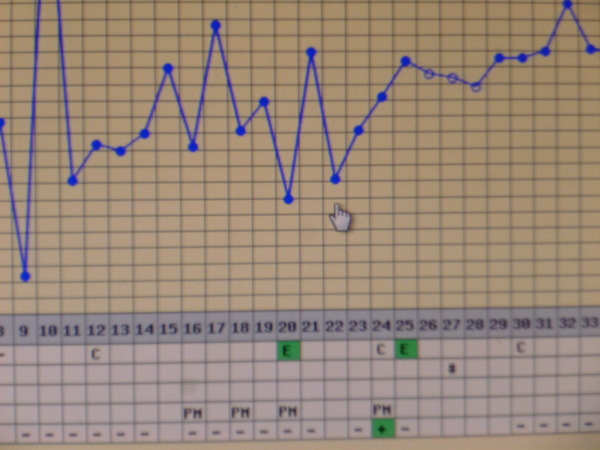 Short Luteal Phase #2
