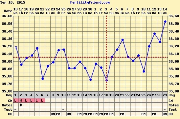 Short Luteal Phase