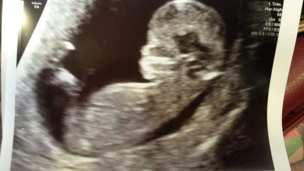 April 2016 babies. Nausea, bloating and wind - feeling HOT!