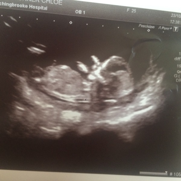 12 week scan. Nub theory? :)