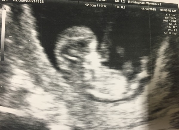 May 2016 babies - thread 2!