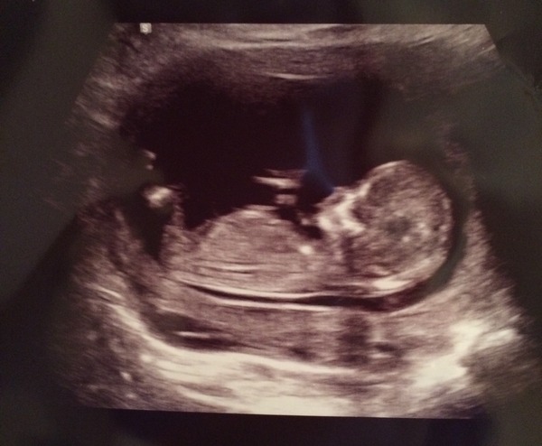 Anyone fancy a guess?