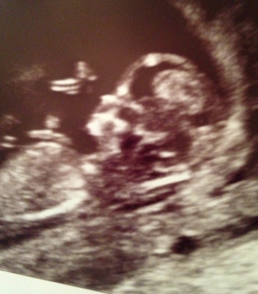 May 2016 babies - thread 2!