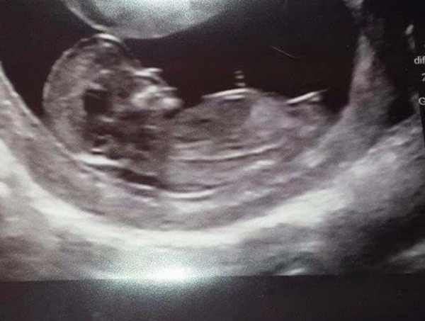 Had our private gender scan today