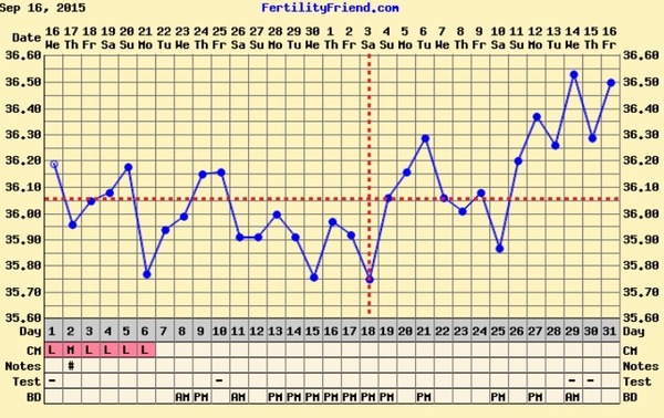 Short Luteal Phase