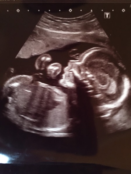 March 2016 Babies!  Here's thread #5!!