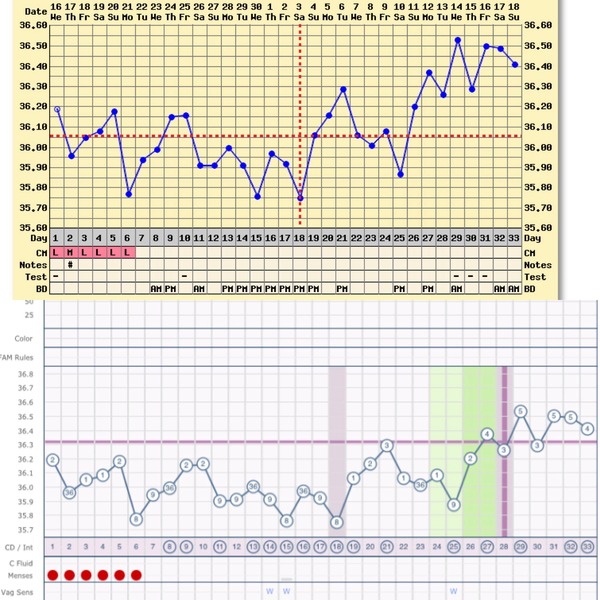 Short Luteal Phase