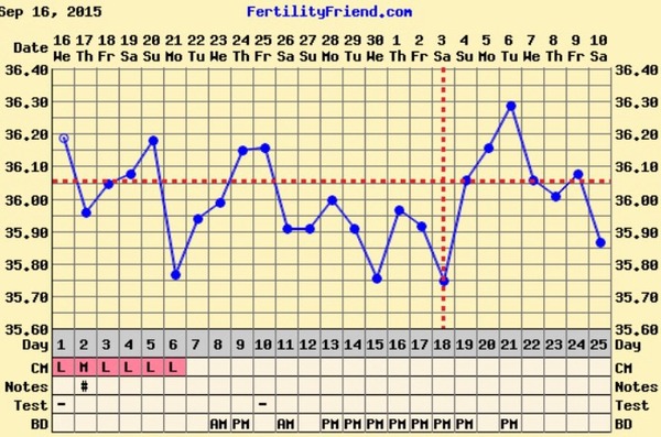 Short Luteal Phase