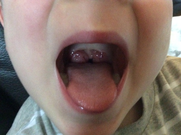 Are these infected??
