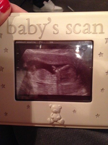Girl or boy-any guesses?