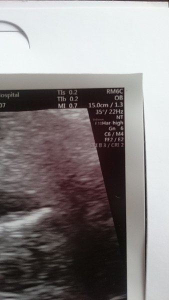 What do all the things on side of scan mean?