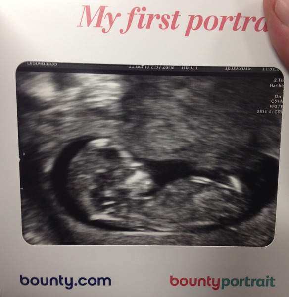 Girl or boy?