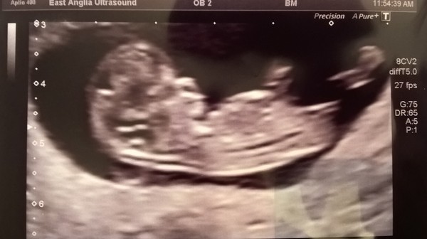 May 2016 babies - thread 2!