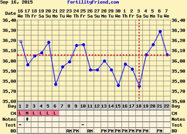 Short Luteal Phase