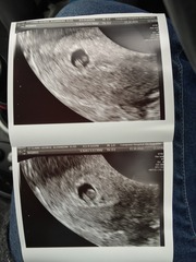 June 2016 Babies - Thread 2 - The first trimester, first scans and seeing little heartbeats