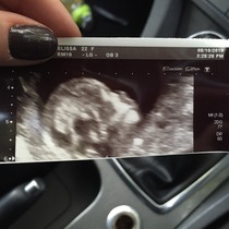 Boy or girl?