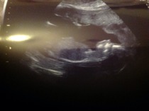 Had our private gender scan today