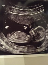 Nub Theory - I'm guessing girl?!