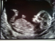 April 2016 babies. Nausea, bloating and wind - feeling HOT!