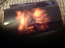 Had our private gender scan today