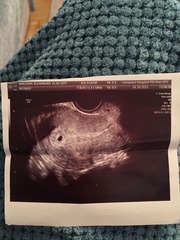June 2016 Babies - Thread 2 - The first trimester, first scans and seeing little heartbeats