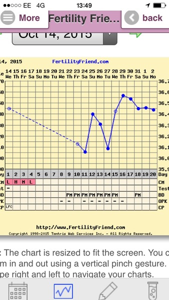 Short Luteal Phase #2
