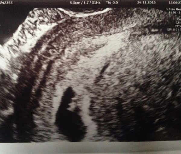 Anyone ttc baby #2?