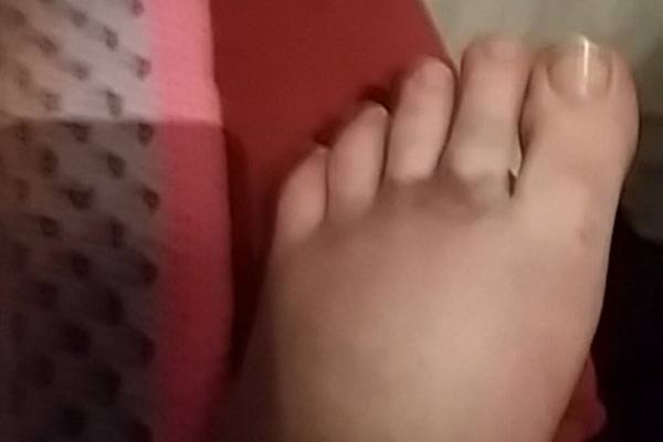 What have I done to my foot- very painful (picture)