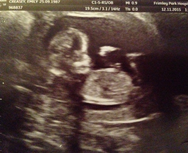 May 2016 - May the sickness end soon!