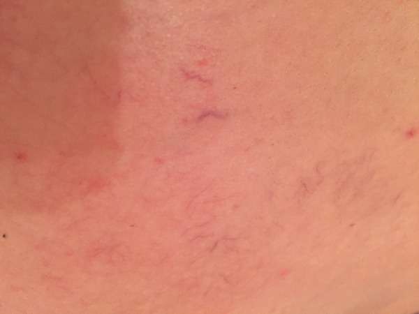 February 2016 Halfway mark: Flutters into kicks into thwacks!