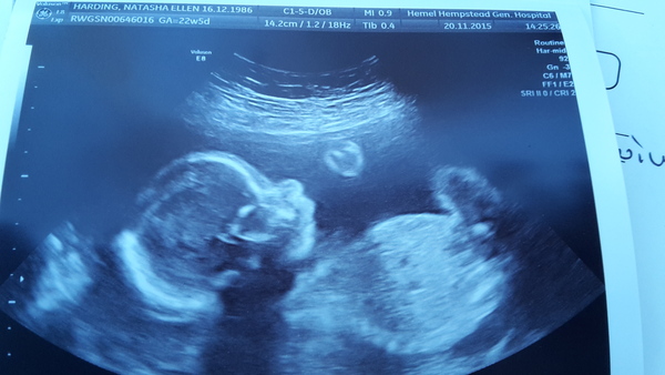 March 2016 #6, we're just breeding here!