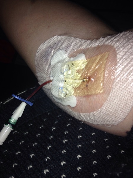 Anyone have a PICC line?