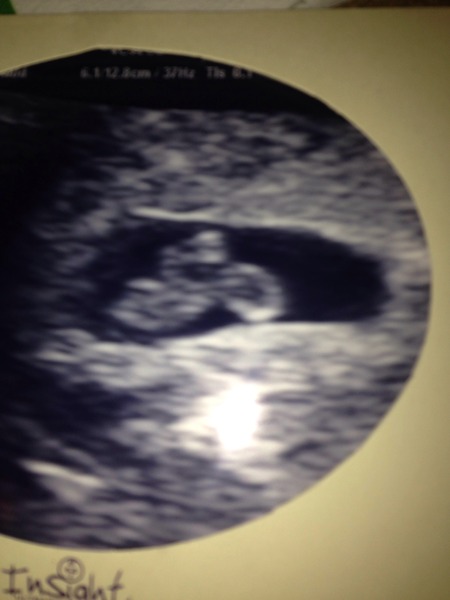 June 2016 #3, 12 week scans - Will you PLEASE hurry up?