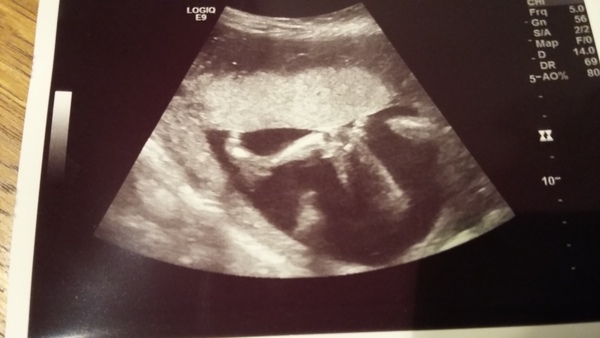 After welcoming the Batlet, we're ready for Halloween, our bellies full of candy and almost nothing green! With accidentally bald fanjos, never-ending nausea, and delinquent babies, it's JS Grads 40!