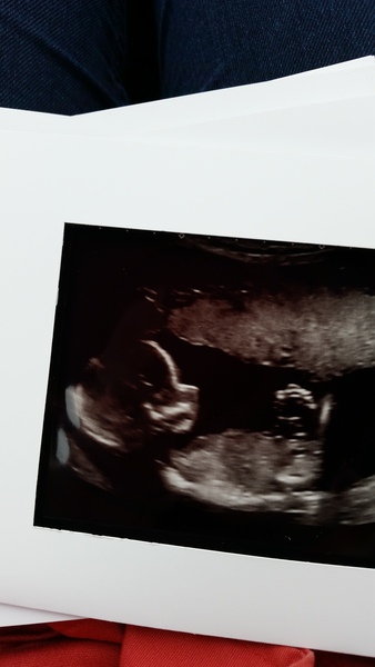 April 2016 babies. Nausea, bloating and wind - feeling HOT!