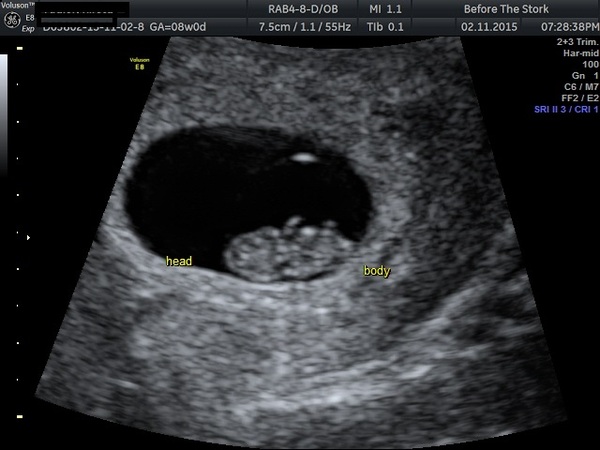 June 2016 #3, 12 week scans - Will you PLEASE hurry up?