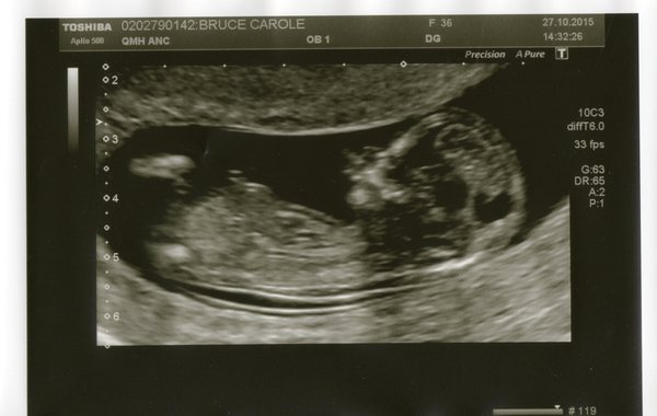 May 2016 - May the sickness end soon!