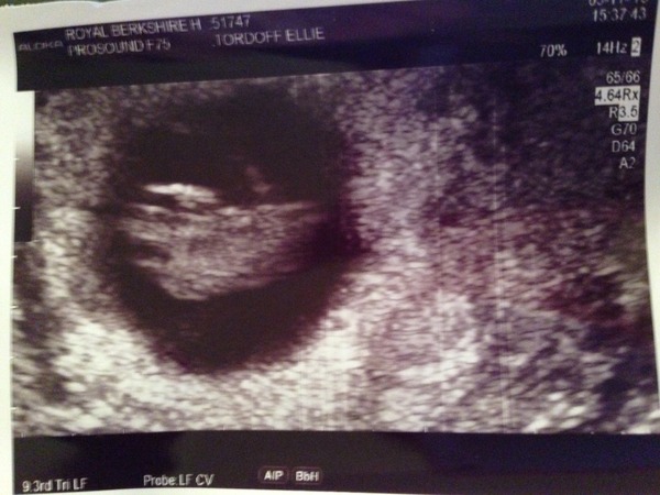 June 2016 #3, 12 week scans - Will you PLEASE hurry up?