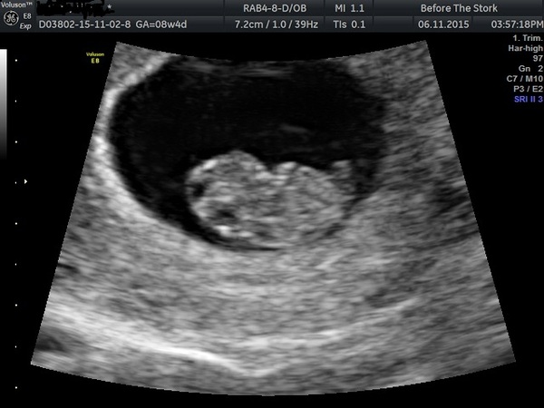 June 2016 #3, 12 week scans - Will you PLEASE hurry up?