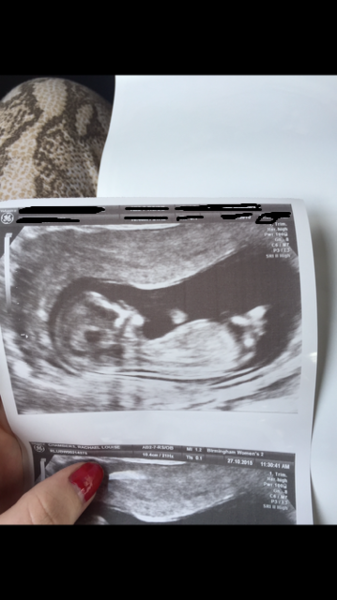 just for fun. Boy or girl?