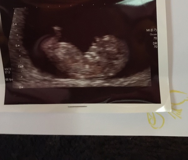 Gender guess?