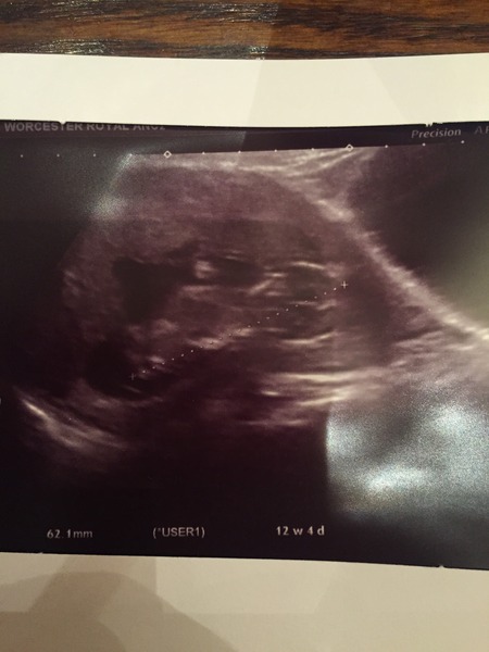 Boy or girl?