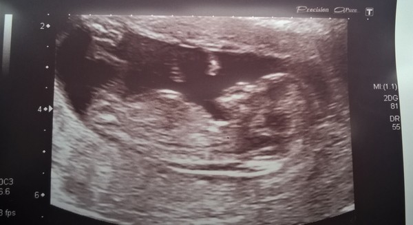 May 2016 - May the sickness end soon!