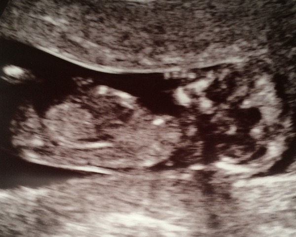 May 2016 - May the sickness end soon!