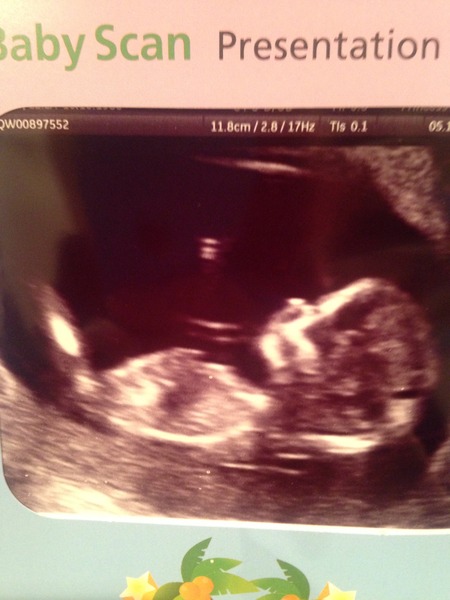 After welcoming the Batlet, we're ready for Halloween, our bellies full of candy and almost nothing green! With accidentally bald fanjos, never-ending nausea, and delinquent babies, it's JS Grads 40!