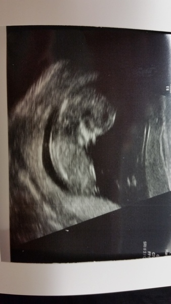 June 2016 #4 - 12 week scans, seeing tiny feet and hands!